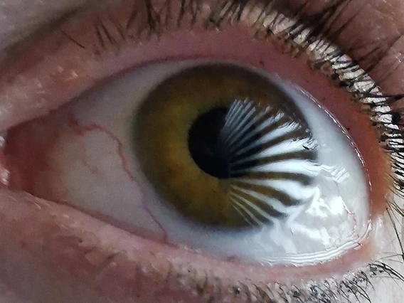 Close-up photo of a human eye, showing the reflection of a pattern of illuminated bars used in the experimental setup